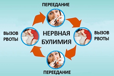 Лечение булимии в Звездном